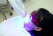 Phương pháp tẩy trắng răng hiệu quả nhất tại nha khoa