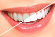 Phương pháp tẩy trắng răng hiệu quả nhất tại nha khoa