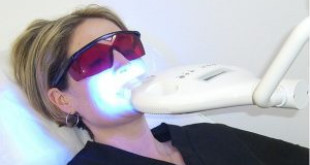 Sự thật ít ai biết của công nghệ tẩy trắng răng đang hot hiện nay