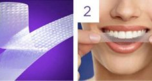 Cách sử dụng miếng dán trắng răng crest  mọi người cần biết