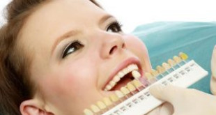 Tất thảy những điều nên biết về tẩy trắng răng an toàn