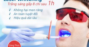 Những cách làm trắng răng hiệu quả nhất tại nha khoa hiện nay