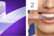 Cách sử dụng miếng dán trắng răng crest  mọi người cần biết
