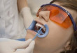 Nên hay không nên tẩy trắng răng: kiến thức bạn cần biết