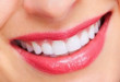 Những cách làm trắng răng từ chanh, có thể bạn chưa biết