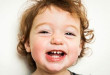 Răng sữa mọc thưa có ảnh hưởng đến răng vĩnh viễn không?