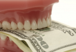 CẬP NHẬT CỰC SHOCK: Bọc răng sứ giá bao nhiêu tiền?