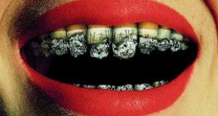 3 Cách làm răng trắng hơn không biết sẽ hối hận cả đời