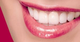 Bọc răng sứ titan cho hàm răng BỀN và ĐẸP nhất