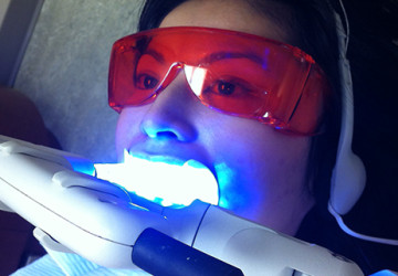 Giờ thì bạn đã biết tẩy trắng răng có hại gì không?