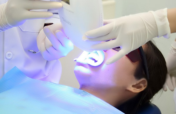  Tẩy trắng răng tại nha khoa với công nghệ đèn Zoom 